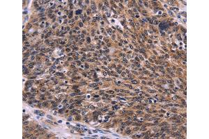 Immunohistochemistry (IHC) image for anti-CDC5 Cell Division Cycle 5-Like (S. Pombe) (CDC5L) antibody (ABIN2429465) (CDC5L 抗体)
