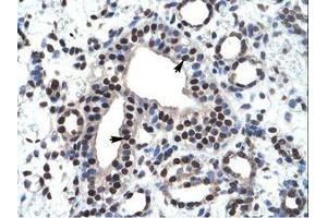 Image no. 1 for anti-Zinc Finger and BTB Domain Containing 45 (ZBTB45) (AA 200-249) antibody (ABIN6735917) (ZBTB45 抗体  (AA 200-249))