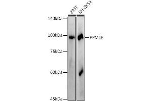 Western blot analysis of extracts of various cell lines, using (ABIN7269695) at 1:1000 dilution. (PPM1E 抗体)