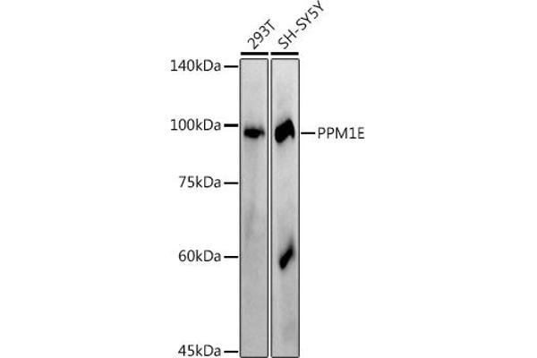 PPM1E 抗体