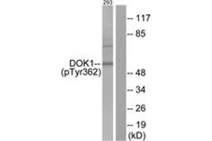 Western blot analysis of extracts from 293 cells, using p62 Dok (Phospho-Tyr362) Antibody. (DOK1 抗体  (pTyr362))