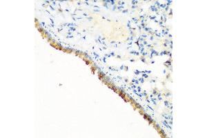 Immunohistochemistry of paraffin-embedded mouse lung using CBL antibody at dilution of 1:200 (40x lens). (CBL 抗体)