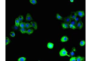 Immunofluorescent analysis of A431 cells using ABIN7164606 at dilution of 1:100 and Alexa Fluor 488-congugated AffiniPure Goat Anti-Rabbit IgG(H+L) (SLC38A6 抗体  (AA 132-169))