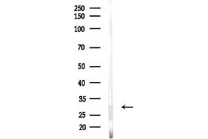 anti-Chromosome 1 Open Reading Frame 163 (C1orf163) (Internal Region) antibody
