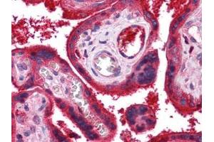 Human Placenta: Formalin-Fixed, Paraffin-Embedded (FFPE) (C9 抗体)