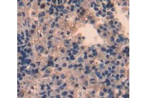 IHC-P analysis of Kidney tissue, with DAB staining. (STAP1 抗体  (AA 1-297))