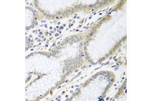 Immunohistochemistry of paraffin-embedded human stomach using RPN2 antibody (ABIN5974836) at dilution of 1/100 (40x lens). (Ribophorin II 抗体)
