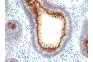 Image no. 1 for anti-Carcinoembryonic Antigen-Related Cell Adhesion Molecule 5 (CEACAM5) antibody (ABIN6151894) (CEACAM5 抗体)