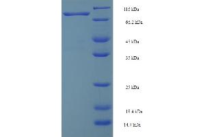 SDS-PAGE (SDS) image for SMAD Specific E3 Ubiquitin Protein Ligase 2 (SMURF2) (AA 1-748), (full length) protein (GST tag) (ABIN5711831) (SMURF2 Protein (AA 1-748, full length) (GST tag))