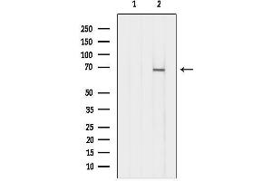anti-Aspartyl-tRNA Synthetase 2, Mitochondrial (DARS2) (Internal Region) antibody