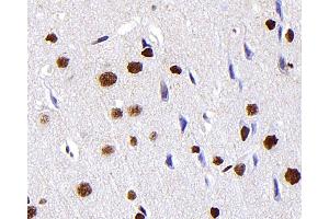 Immunohistochemistry analysis of paraffin-embedded Rat brain using S100A4 Monoclonal Antibody at dilution of 1:300. (s100a4 抗体)