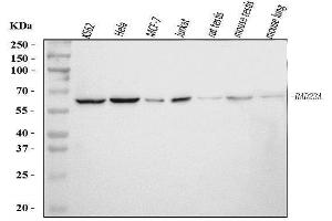 Western blot analysis of HHR23A/RAD23A using anti-HHR23A/RAD23A antibody (ABIN7603222).