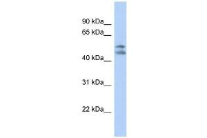 PAFAH1B1 antibody used at 1 ug/ml to detect target protein. (PAFAH1B1 抗体  (N-Term))
