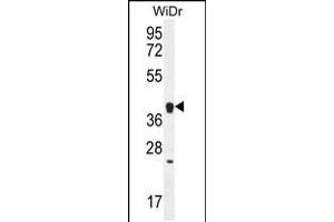 Western blot analysis in WiDr cell line lysates (35ug/lane). (OR2T8 抗体  (C-Term))