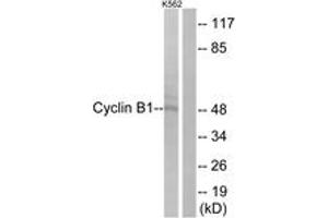 Western Blotting (WB) image for anti-Cyclin B1 (CCNB1) (AA 91-140) antibody (ABIN2888597) (Cyclin B1 抗体  (AA 91-140))