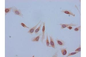 Immunocytochemistry analysis of Hela cells using ABIN7139184 at dilution of 1:100 (HIST1H2BB 抗体  (acLys5))