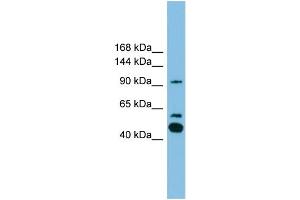 WB Suggested Anti-PLA2G4E Antibody Titration: 0. (PLA2G4E 抗体  (C-Term))