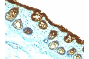 Immunohistochemistry (IHC) image for anti-Keratin 19 (KRT19) antibody (ABIN6939947)