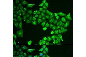 Immunofluorescence analysis of HeLa cells using ASL Polyclonal Antibody (ASL 抗体)