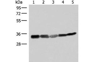 Western blot analysis of 293T HepG2 and A549 cell lysates using ECH1 Polyclonal Antibody at dilution of 1:200 (ECH1 抗体)