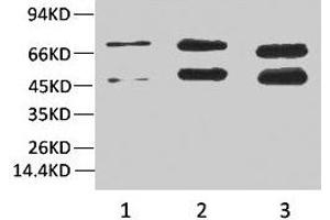 Western blot analysis of 1) Hela, 2)Rat Brain Tissue, 3) Mouse Brain Tissue with Phosphoserine Mouse mAb diluted at 1:2000. (Phosphoserine 抗体)