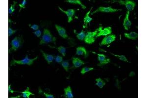 Immunofluorescence staining of U251 cells with ABIN7143283 at 1:160,counter-stained with DAPI. (ADA 抗体  (AA 157-343))