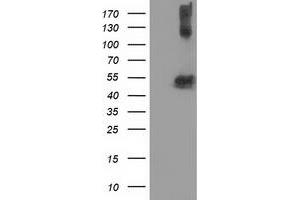 Western Blotting (WB) image for anti-Tubulin beta 4a (TUBB4A) antibody (ABIN1501580) (TUBB4 抗体)
