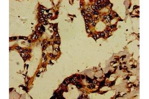 Immunohistochemistry (IHC) image for anti-Recombination Signal Binding Protein For Immunoglobulin kappa J Region-Like (RBPJL) (AA 1-151) antibody (ABIN7167538)