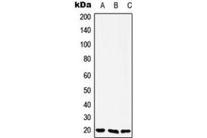 Western blot analysis of YAF2 expression in Jurkat (A), Raw264. (YAF2 抗体  (N-Term))