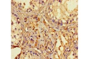 Immunohistochemistry of paraffin-embedded human testis tissue using ABIN7142130 at dilution of 1:100 (RNASEL 抗体  (AA 330-741))