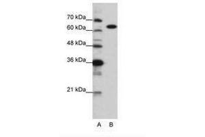 Image no. 1 for anti-Lysyl-tRNA Synthetase (KARS) (C-Term) antibody (ABIN6749717) (KARS 抗体  (C-Term))