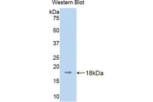 Western blot analysis of the recombinant protein. (KIF5A 抗体  (AA 473-605))