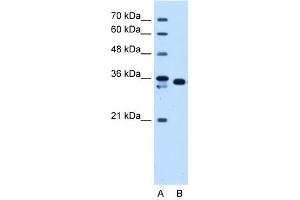 AKR1B1 antibody used at 1. (AKR1B1 抗体)