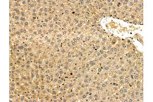ABIN6257431 and ABIN6275975 at 1/100 staining Rat liver tissue by IHC-P. (PTH1R 抗体  (pThr1))