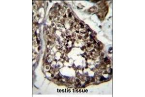 TBCEL Antibody (C-term) (ABIN656361 and ABIN2845658) immunohistochemistry analysis in formalin fixed and paraffin embedded human testis tissue followed by peroxidase conjugation of the secondary antibody and DAB staining. (TBCEL 抗体  (C-Term))