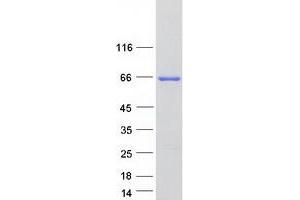 Western Blotting (WB) image for Carnitine O-Acetyltransferase (CRAT) (Transcript Variant 2) protein (Myc-DYKDDDDK Tag) (ABIN2713183)