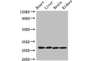 Western Blot Positive WB detected in: Mouse heart tissue, Mouse liver tissue, Mouse brain tissue, Mouse kidney tissue All lanes: PRSS2 antibody at 3 μg/mL Secondary Goat polyclonal to rabbit IgG at 1/50000 dilution Predicted band size: 27 kDa Observed band size: 27 kDa (PRSS2 抗体  (AA 24-247))