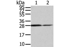 Western Blot analysis of Mouse stomach and Human fetal muscle tissue using RHOU Polyclonal Antibody at dilution of 1/200 (RHOU 抗体)
