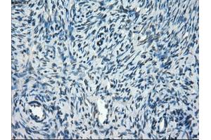 Immunohistochemical staining of paraffin-embedded colon tissue using anti-TMEM100mouse monoclonal antibody. (TMEM100 抗体)