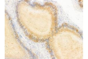 ABIN7096897 and ABIN7100963 at 1/100 staining human testicular cancer by IHC-P. (NAA30 抗体)