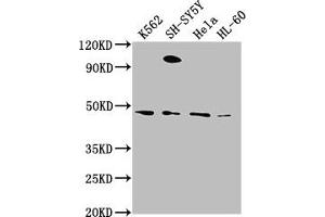 Western Blot Positive WB detected in: K562 whole cell lysate, SH-SY5Y whole cell lysate, Hela whole cell lysate, HL-60 whole cell lysate All lanes: RTN4RL2 antibody at 1:2000 Secondary Goat polyclonal to rabbit IgG at 1/50000 dilution Predicted band size: 47, 22 kDa Observed band size: 47 kDa (RTN4RL2 抗体  (AA 355-372))