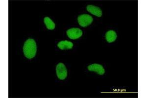 Immunofluorescence of purified MaxPab antibody to ZNF189 on HeLa cell. (ZNF189 抗体  (AA 1-584))