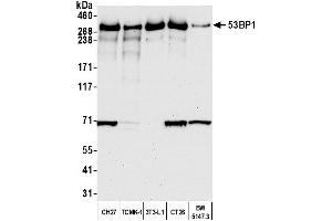 anti-Tumor Protein P53 Binding Protein 1 (TP53BP1) (AA 350-400) antibody
