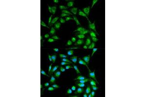 Immunofluorescence analysis of MCF7 cell using ICOS antibody. (ICOS 抗体  (AA 21-140))