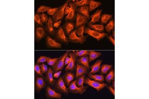 Immunofluorescence analysis of U2OS cells using CK antibody (ABIN6127628, ABIN6138647, ABIN6138648 and ABIN6224627) at dilution of 1:100.