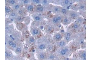 Immunohistochemistry (IHC) image for anti-Patched 1 (PTCH1) (AA 213-422) antibody (ABIN7439540)