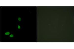 Immunofluorescence analysis of HeLa cells, using HMG17 Antibody. (HMGN2 抗体  (AA 1-50))