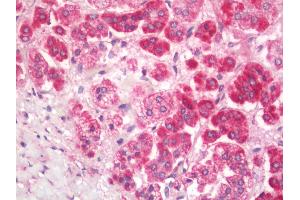 Human Adrenal: Formalin-Fixed, Paraffin-Embedded (FFPE).