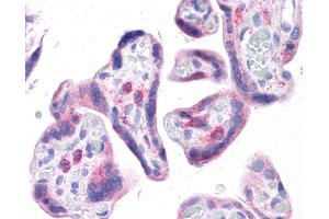 Immunohistochemistry (IHC) image for anti-Leucine Rich Repeat Containing 59 (LRRC59) (N-Term) antibody (ABIN2783711) (LRRC59 抗体  (N-Term))