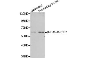 Western Blotting (WB) image for anti-Forkhead Box O4 (FOXO4) (pSer197) antibody (ABIN1870198) (FOXO4 抗体  (pSer197))